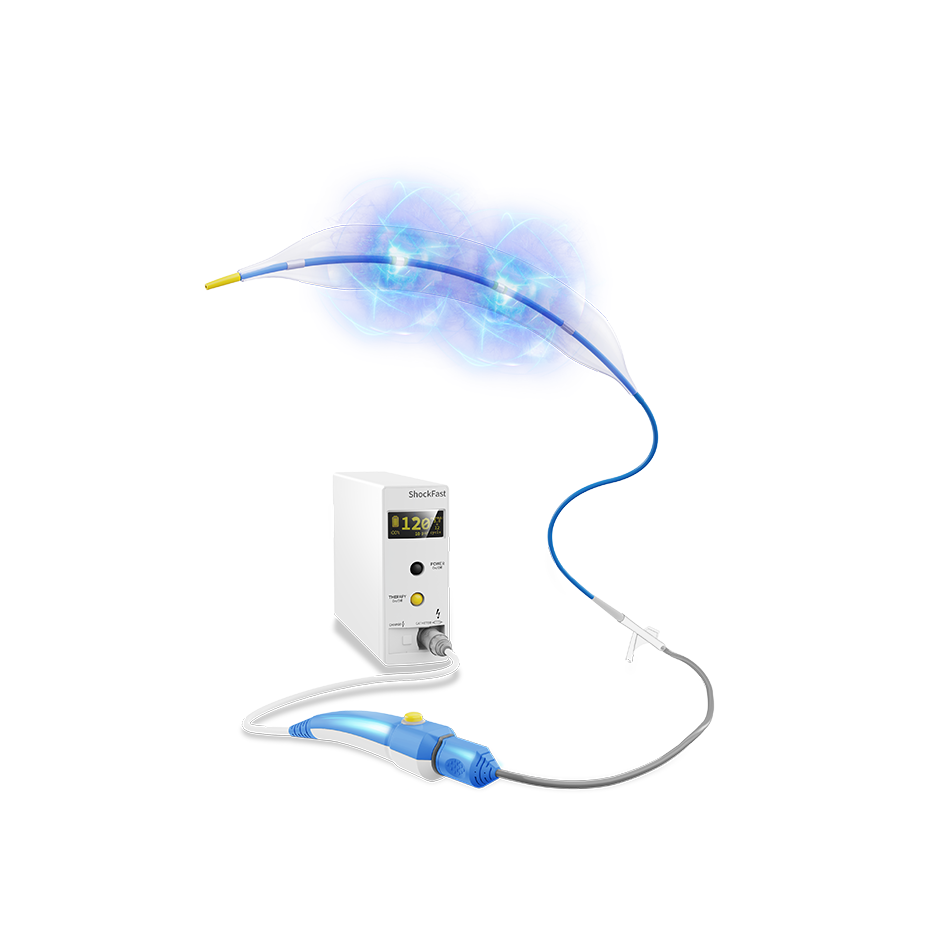 Coronary IVL Catheter-ShockFast