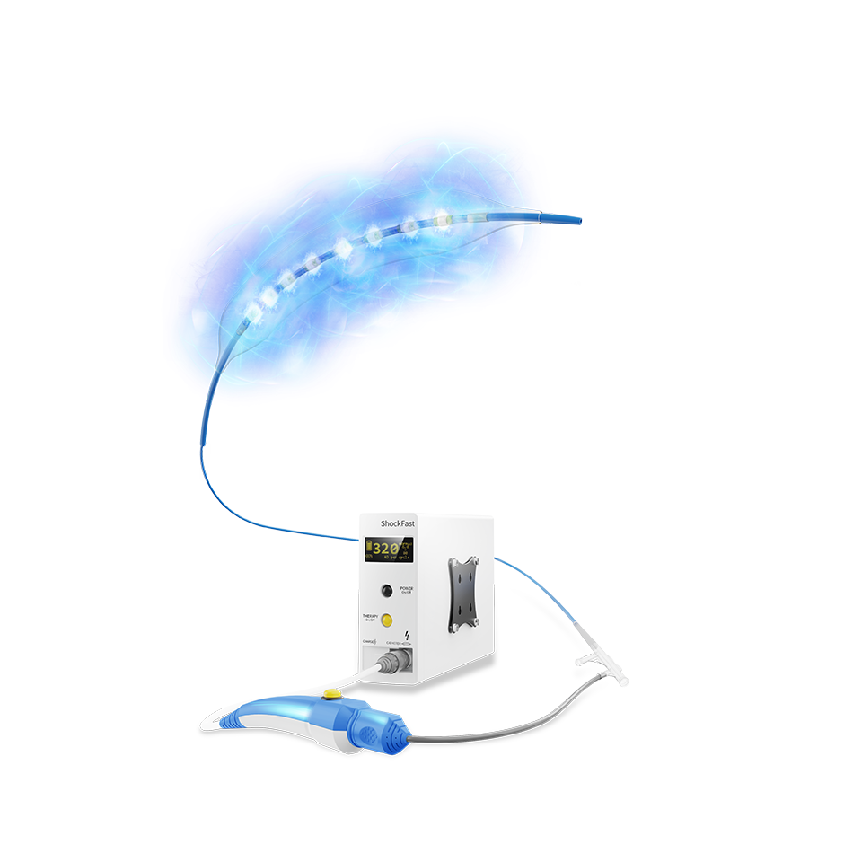 Peripheral IVL Catheter-ShockFast